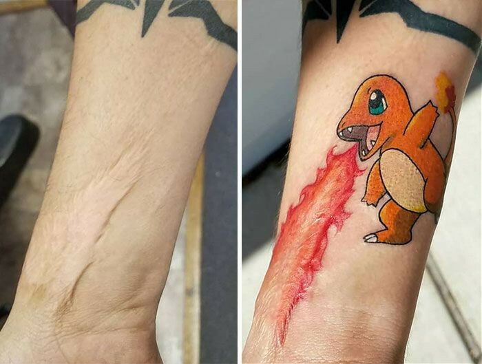Scar Cover-Up