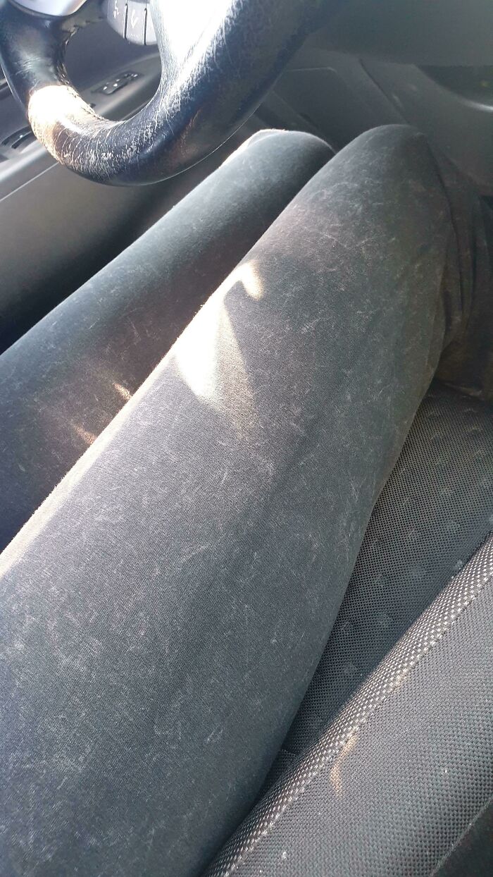 The Design On My Girlfriend's Yoga Pants Make It Look Like It's Covered In Fur