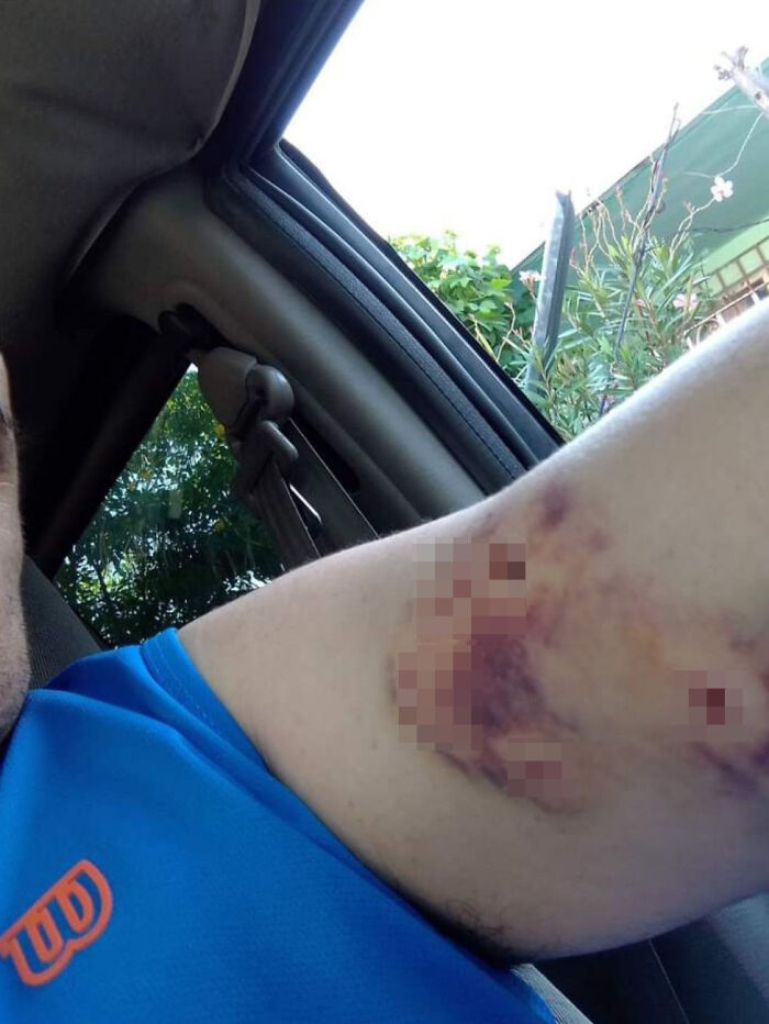 Man Rescued A Dog That Bit Him And His Story Went Viral Man Rescued A Dog That Bit Him And His Story Went Viral