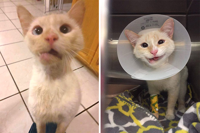 Antes y después de la operación de mandíbula