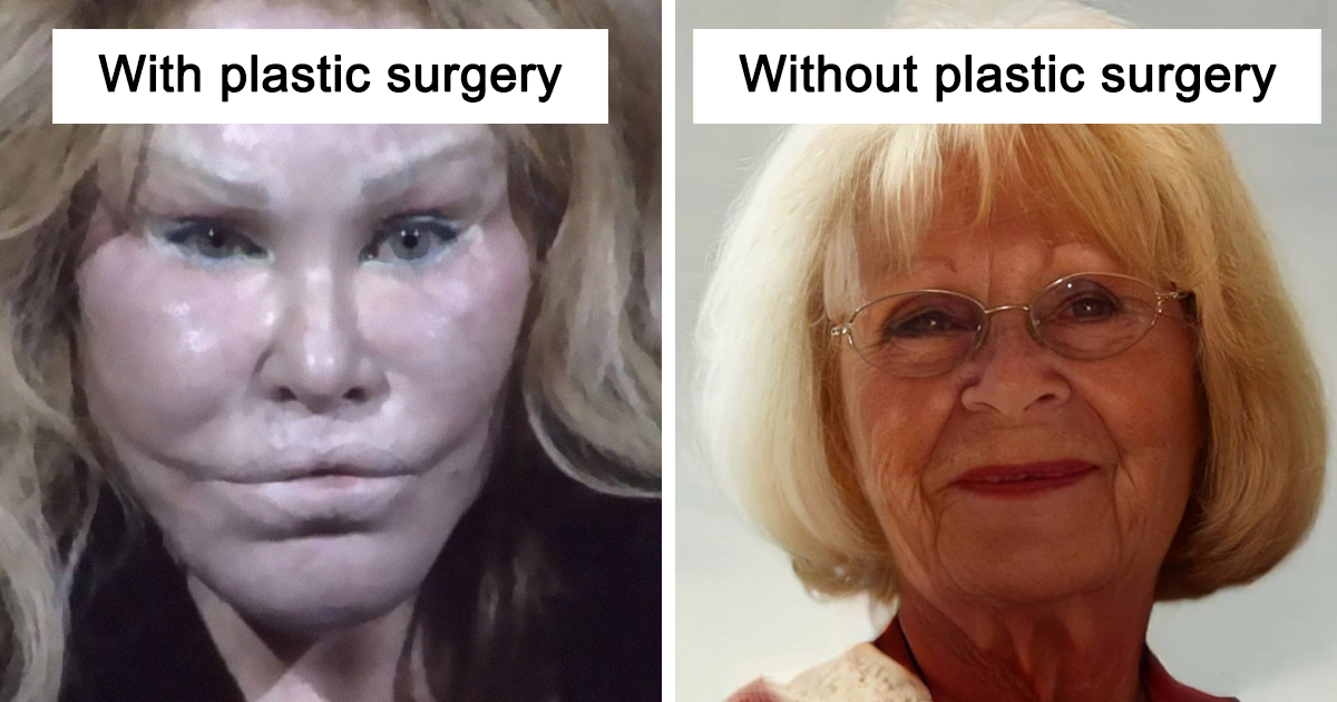 Types Of Plastic Surgery