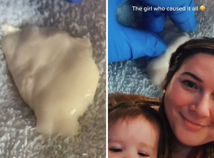 New Mom Shares Her Horror Story Of Going Septic Because Doctors Did Not Believe Her, Wants To Warn Others New Mom Shares Her Horror Story Of Going Septic Because Doctors Did Not Believe Her, Wants To Warn Others