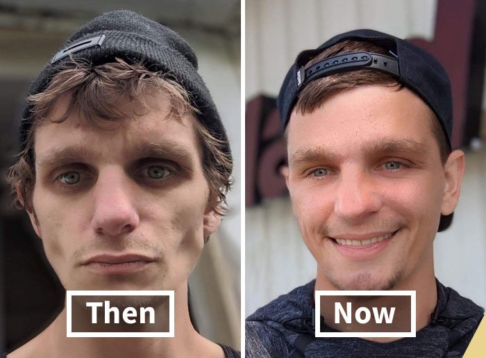 ‘The Addict’s Diary’: 30 Powerful Before & After Transformations Of Drug Addicts (New Stories)