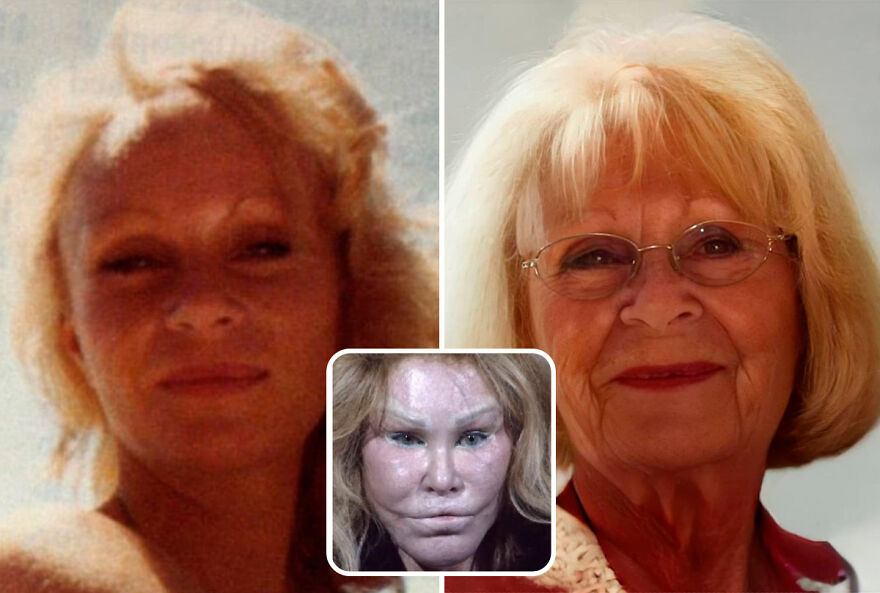 Jocelyn Wildenstein, 81 Years Old