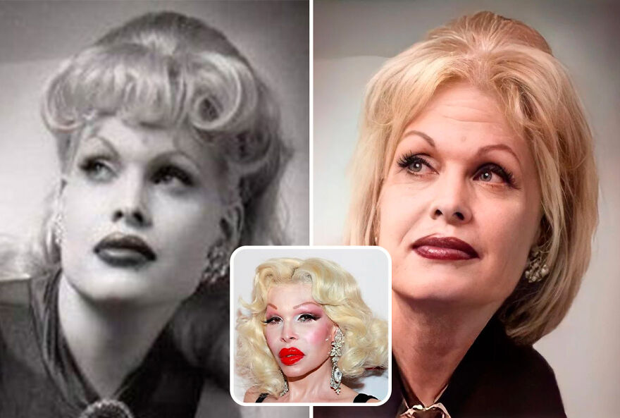 Amanda Lepore Plastic Surgery