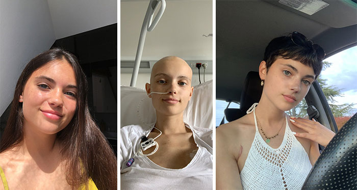 Before And After Beating Cancer. 2019-2020-2021