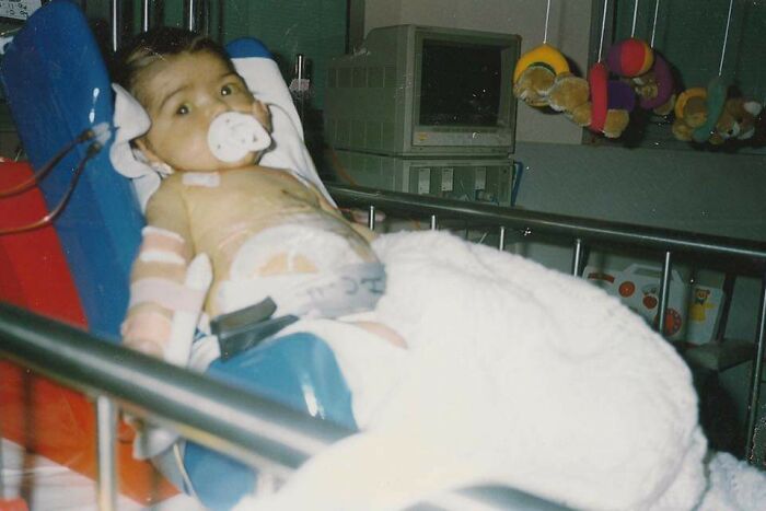 Fui el primer bebé en Victoria, Australia, en recibir un transplante de hígado. Ahora tengo 24 años