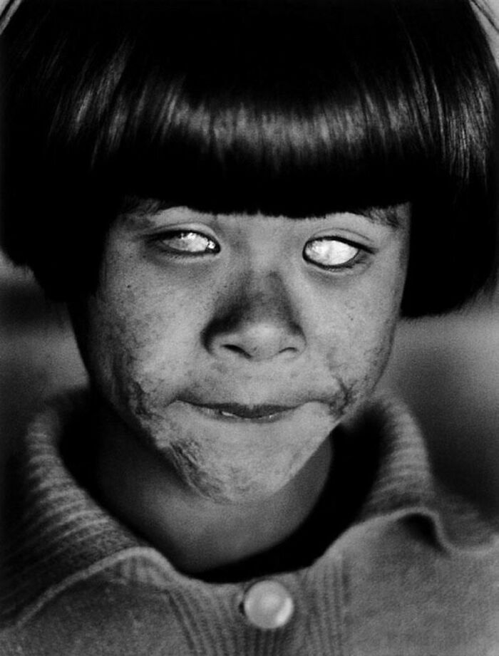 Eyes That Have Seen A Nuclear Blast. Hiroshima, Japan; August 8, 1945