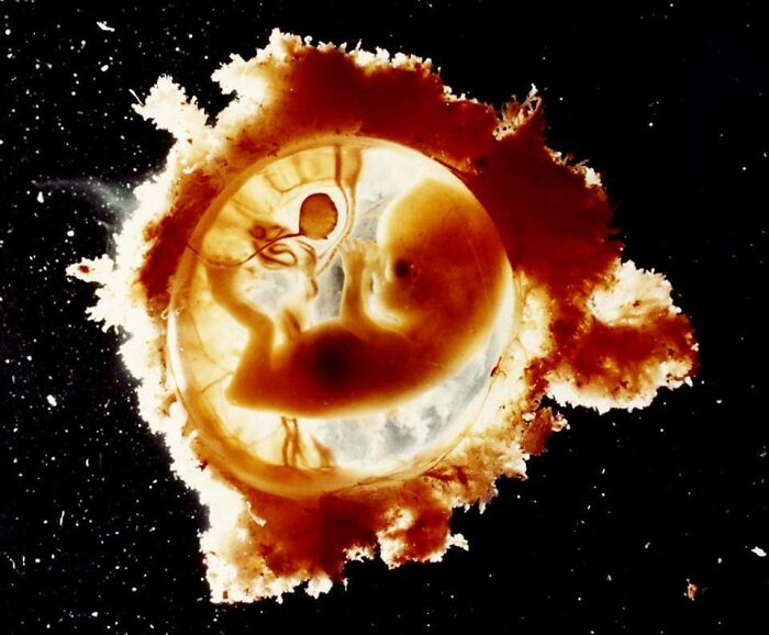 Foetus Developing In The Womb. Incredible Work By Lennart Nilsson Who Pioneered The Use Of Endoscopy And Took Pictures Inside The Human Body