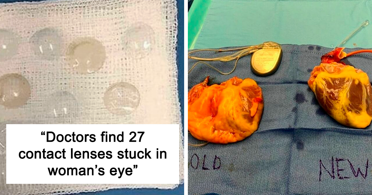 50 Amazing Medical Cases That Are Interesting And Bizarre At The Same