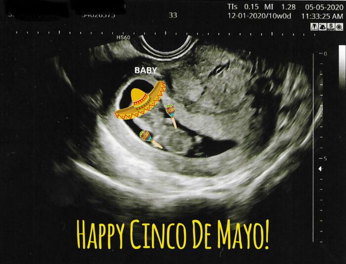 My Fiancé And I Had Our Ultrasound On 5/5 But Because Of The Quarantine We Couldn’t Celebrate. So I Made This. She Did Not Find It As Humorous As I Did