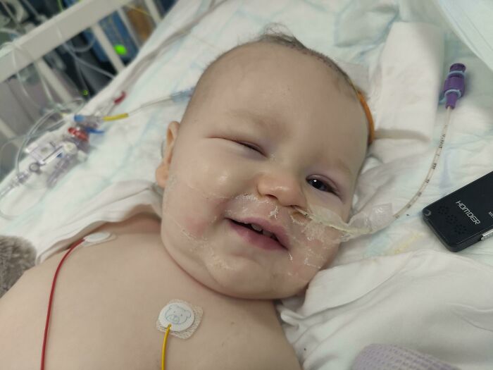Mi hijo de 11 meses acaba de salir del respirador esta mañana después de un aneurisma cerebral que se produjo hace 12 días. Va a llegar a su primer cumpleaños en Nochebuena