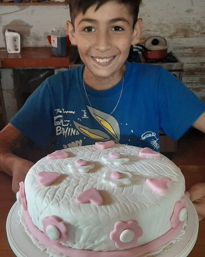 In Argentina, A 10-Year-Old Boy Works As A Confectioner To Pay For His Reconstruction Surgery