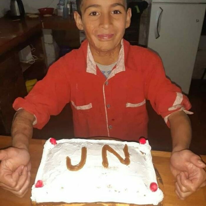 In Argentina, A 10-Year-Old Boy Works As A Confectioner To Pay For His Reconstruction Surgery
