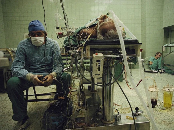 This Is In 1987, Zbigniew Religa After A 23 Hour Heart Transplant, Watching His Patient’s Vital Signs. In The Lower Right Corner, You Can See One Of His Colleagues Who Helped Him With The Surgery Fallen Asleep