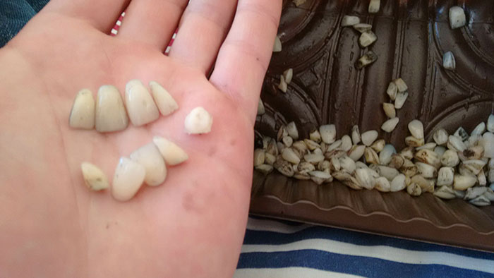 Moved Into A New House. The Kids Found Dozens Of Fake Teeth Under A Crumbling Paving Stone