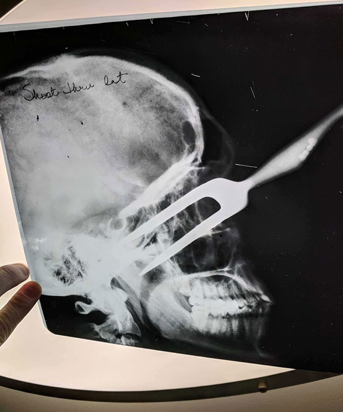 My Buddy Bought A House Found Some X-Rays In An Old Box