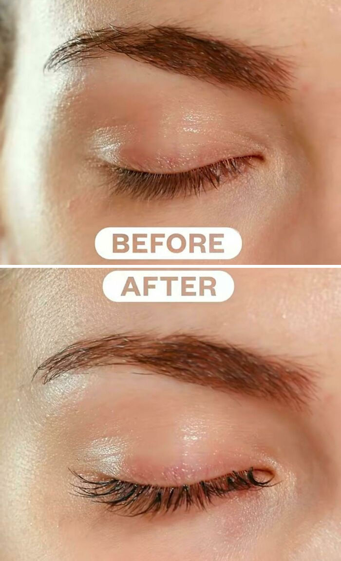 A "Before And After" Of A Serum That Is Supposed To Give You Longer Lashes. You Can Clearly See The Eyelash Extension Clusters