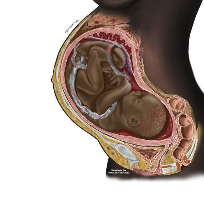 Many Online Have Never Seen A Black Fetus Illustrated, And Now Express Their Surprise After Finding One Many Online Have Never Seen A Black Fetus Illustrated, And Now Express Their Surprise After Finding One