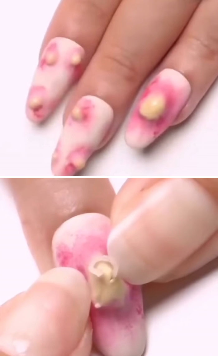 Pimple Nails