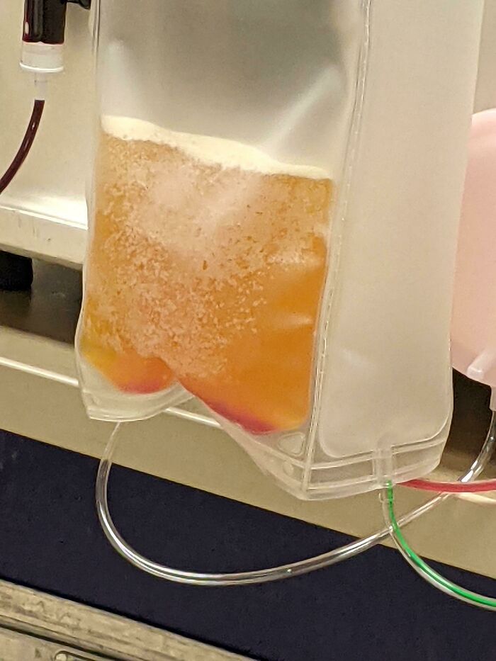 What Blood Looks Like With The Red Blood Cells Removed
