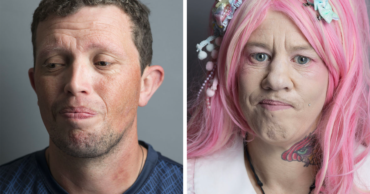 Faces And Stories Of People With Mental Or Physical Illnesses: 16 Portraits I Took - Vimarsana News