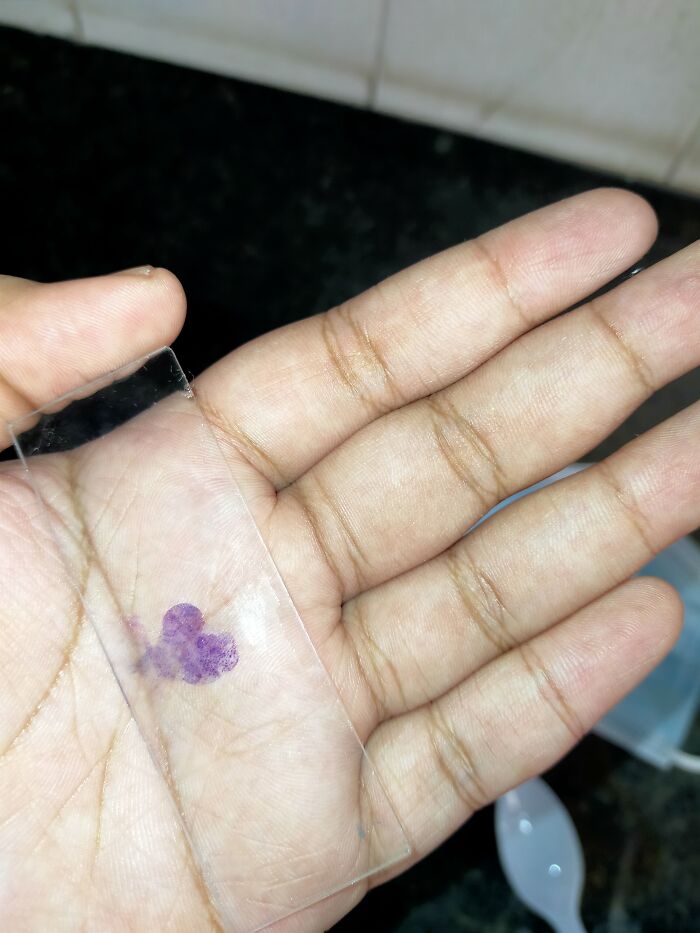 I Know This Is A Weird Addition To This List But I Can't Help It. We Had To Stain A Sample In Biology Lab And When I Stained And Rubbed Away The Excess Stain It Formed A Beautiful Heart Shape!!!
