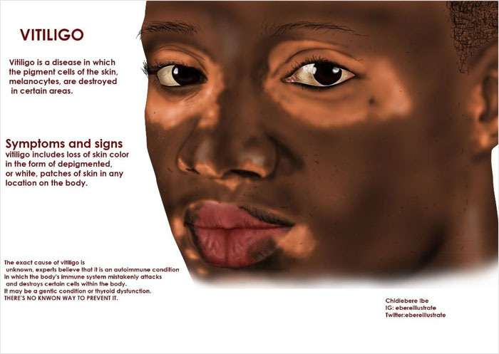 Many Online Have Never Seen A Black Fetus Illustrated, And Now Express Their Surprise After Finding One Many Online Have Never Seen A Black Fetus Illustrated, And Now Express Their Surprise After Finding One