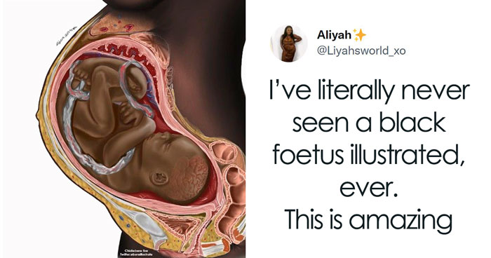 Many Online Have Never Seen A Black Fetus Illustrated, And Now Express Their Surprise After Finding One