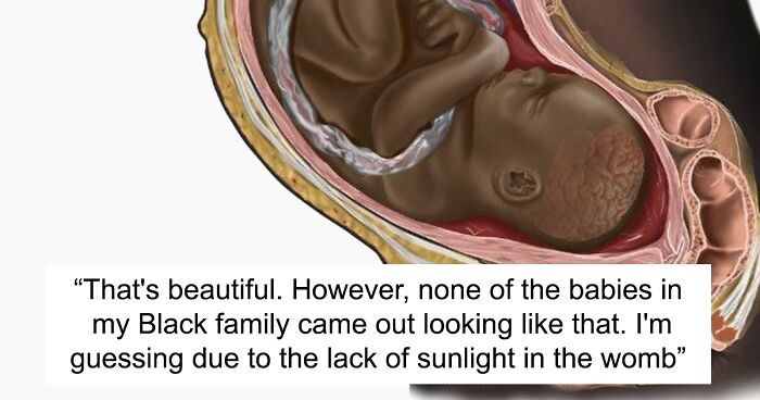 Many Online Have Never Seen A Black Fetus Illustrated, And Now Express Their Surprise After Finding One