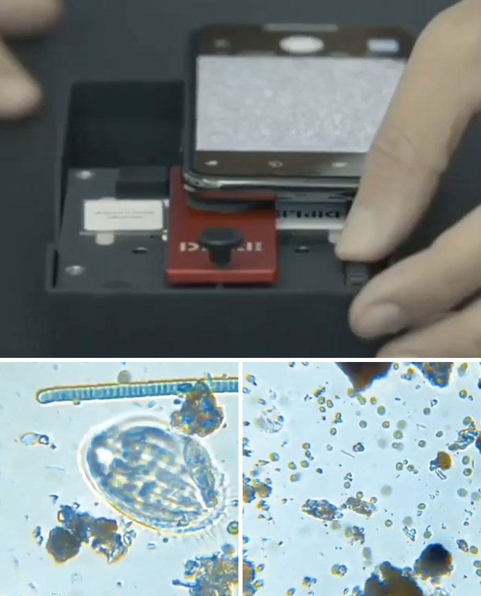 Kit That Transforms Your Smartphone Into Microscope Promises Up To 1,000x Magnification