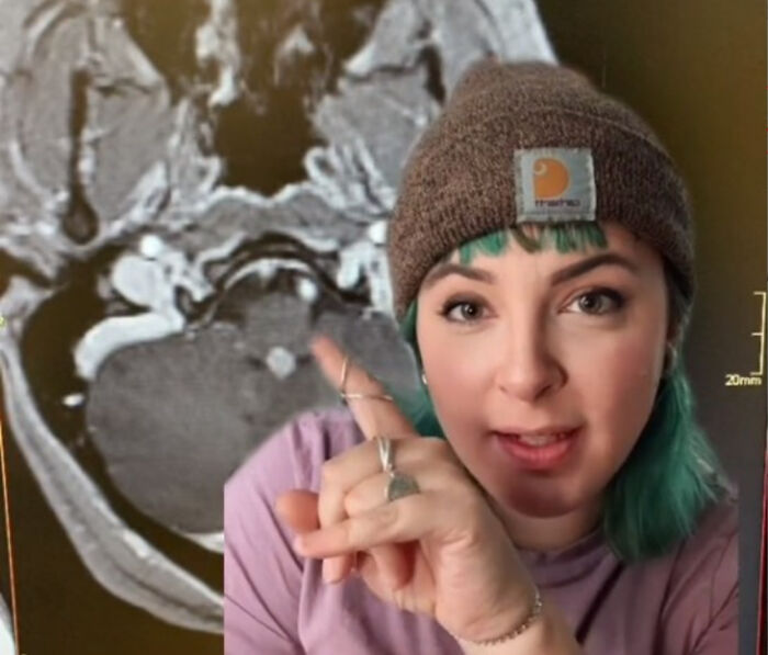Woman With Brain Tumor Scared And Heartbroken Over The Fact She Can't Get It Removed Because Of Unvaccinated People Woman With Brain Tumor Scared And Heartbroken Over The Fact She Can't Get It Removed Because Of Unvaccinated People