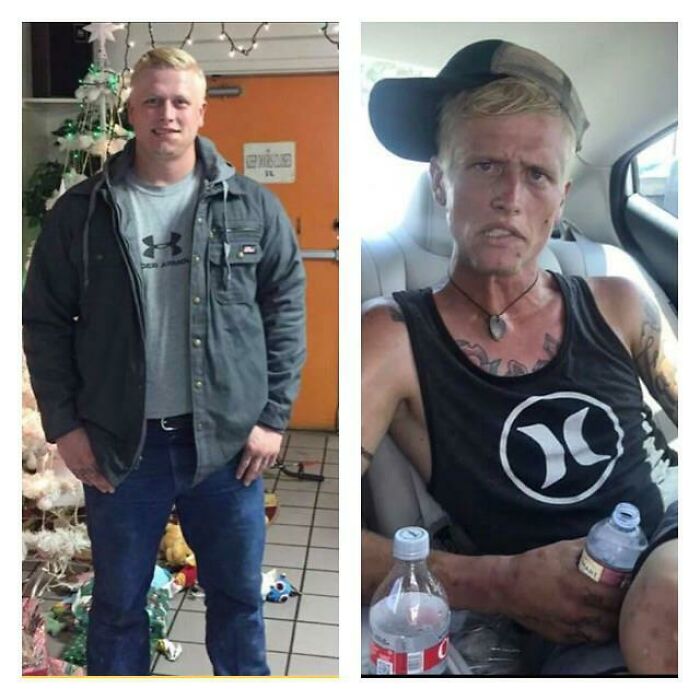 Mother Shows What Seven Months Of Heroin And Meth Addiction Can Do