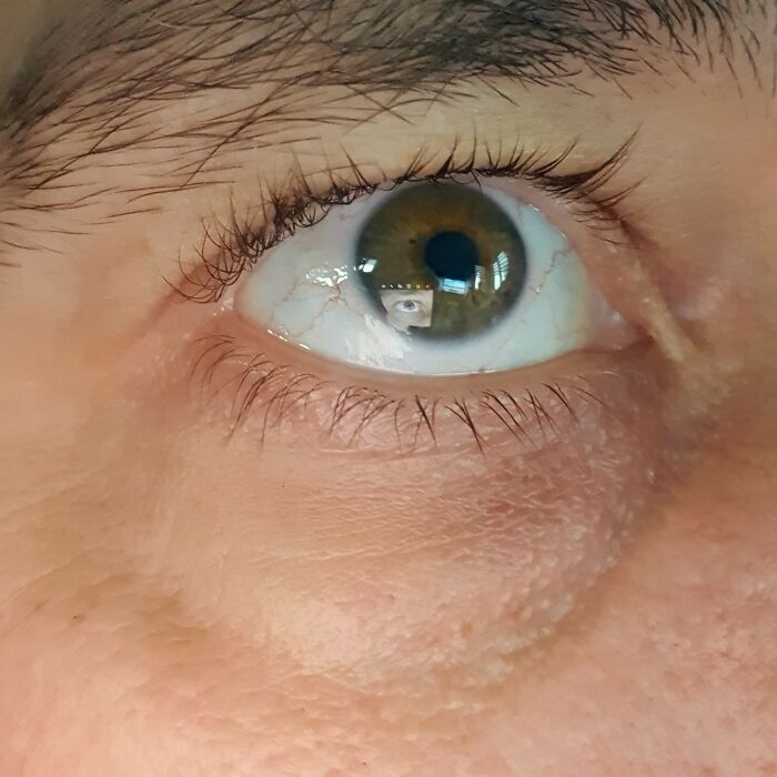 I Can See The Reflection Of My Phone If I Take A Close-Up Of My Eye