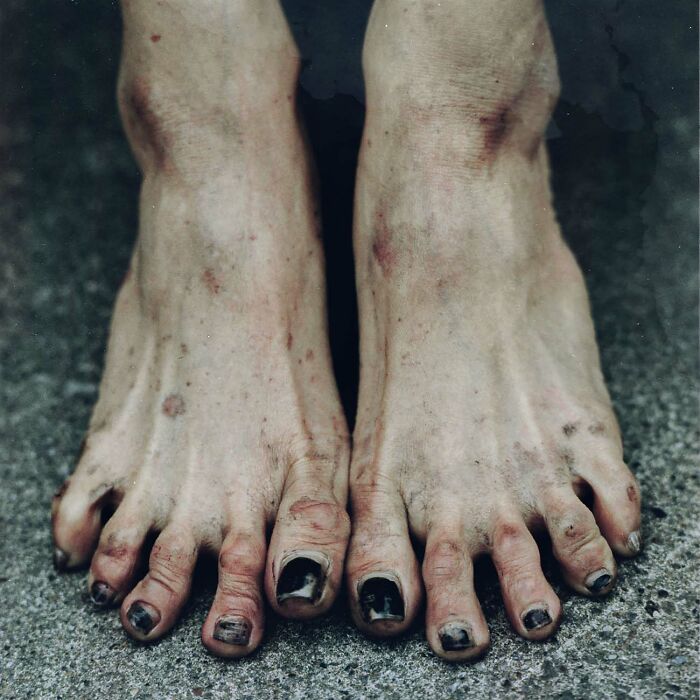 Los pies de Julie T, de la serie “Embrasure” de Julie Fowells