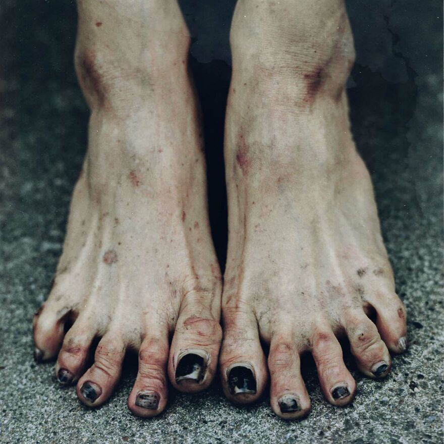 Close-up photo of bare feet with chipped black nail polish and visible dirt, captured by photographers.