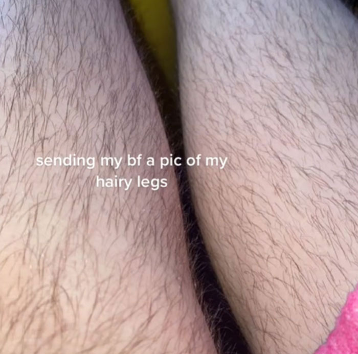 Woman Sends Her Boyfriend A Pic Of Her Hairy Legs To Have A Laugh, Doesn't Expect He Would Respond By Shaming Her Woman Sends Her Boyfriend A Pic Of Her Hairy Legs To Have A Laugh, Doesn't Expect He Would Respond By Shaming Her