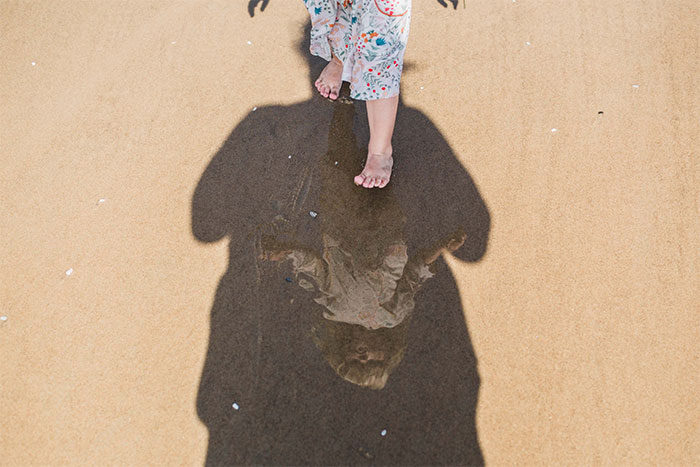 I Found A Creative Way To Protect My Daughter, Who Has Cleft Lip, And Still Share Cute Pictures Of Her Daily Life Online (30 Pics)