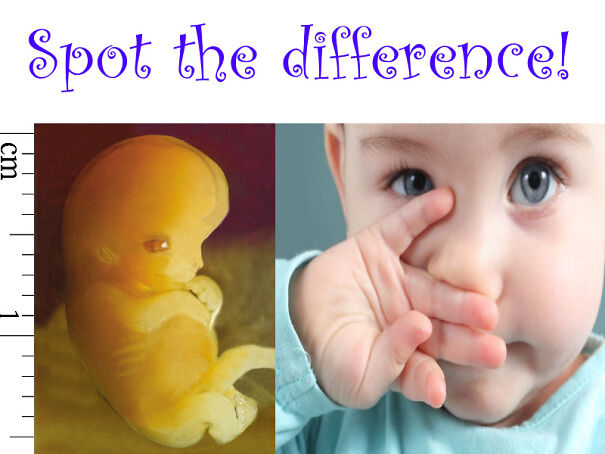 spot-the-difference-61eee6040a905-png.jpg