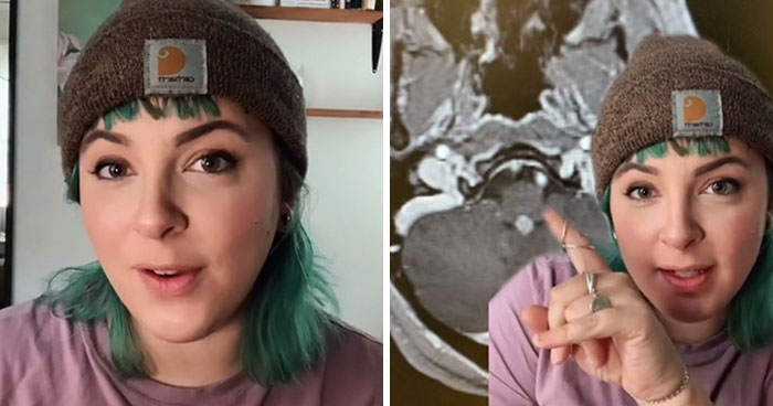 Woman With Brain Tumor Scared And Heartbroken Over The Fact She Can’t Get It Removed Because Of Unvaccinated People