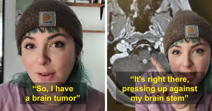 Woman With Brain Tumor Scared And Heartbroken Over The Fact She Can’t Get It Removed Because Of Unvaccinated People