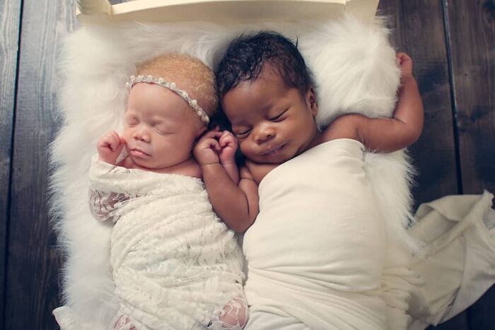 Woman Gave Birth To Black And White Twins, Thought She Was Handed The Wrong Baby