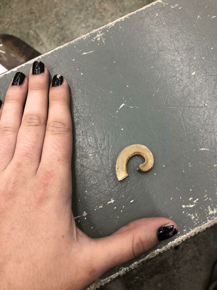 This Toenail I Cut Off Of A Dog Yesterday, Hand For Scale