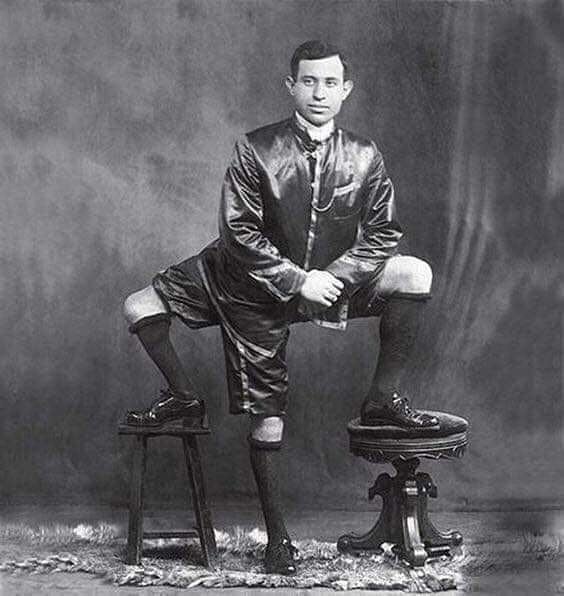 Frank Lentini, Owner Of 3 Legs, 4 Feet, 16 Toes, And 2 Functioning Sets Of Genitals. (1884-1966)