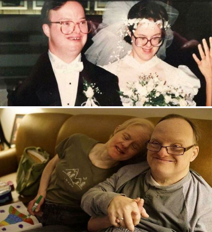 Couple With Down Syndrome Told Not To Marry, Prove Critics Wrong 25 Years Later