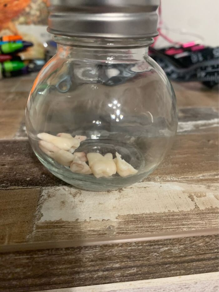 My Jar Of Teeth I Own. I Will Soon Add More.