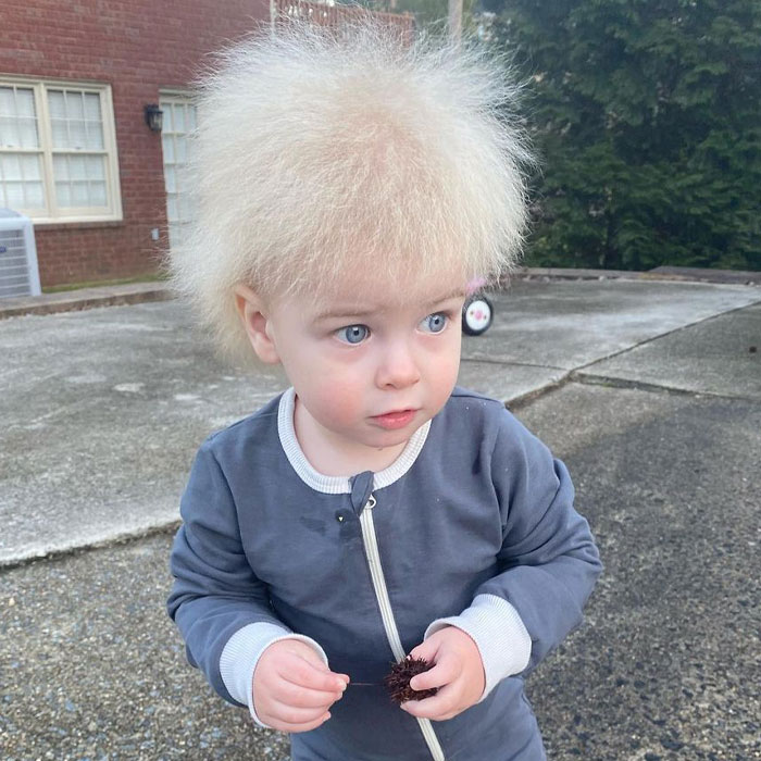 Happy Toddler Diagnosed With Uncombable Hair Syndrome Shows There Is No Such Thing As A Bad Hair Day