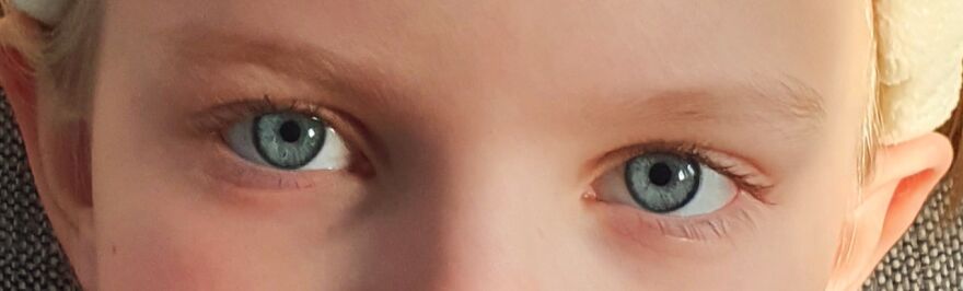 Our Family Eyes. Everyone In My Family Has Blue Eyes With A Dark Ring.
