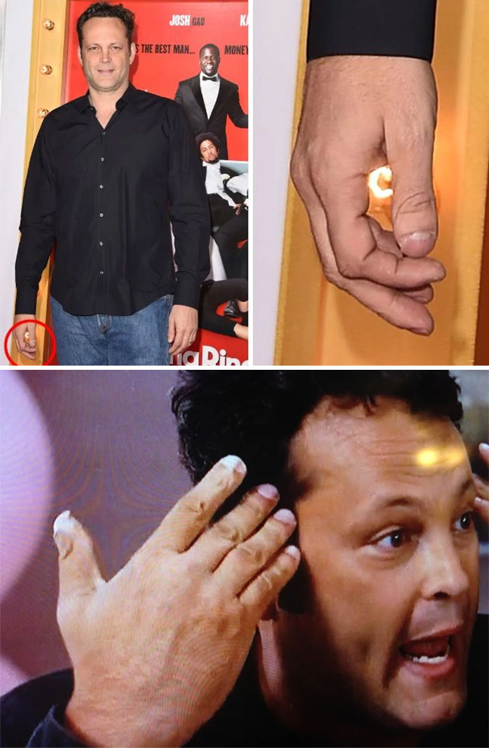 Vince Vaughn Is Missing Part Of His Thumb
