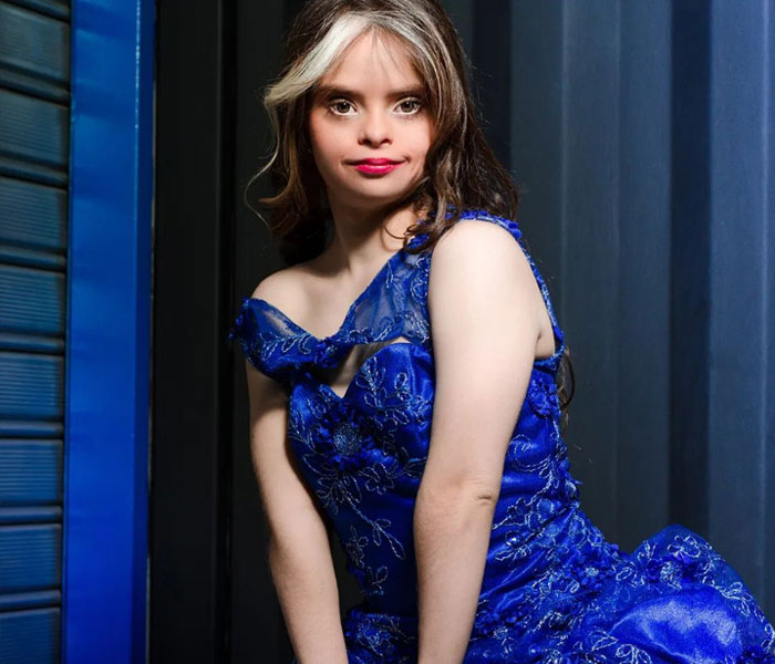 Jessica, A Model With Down Syndrome, Is Shattering Beauty Standards And Paving The Way For Others